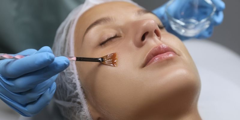 Chemical peel treatment