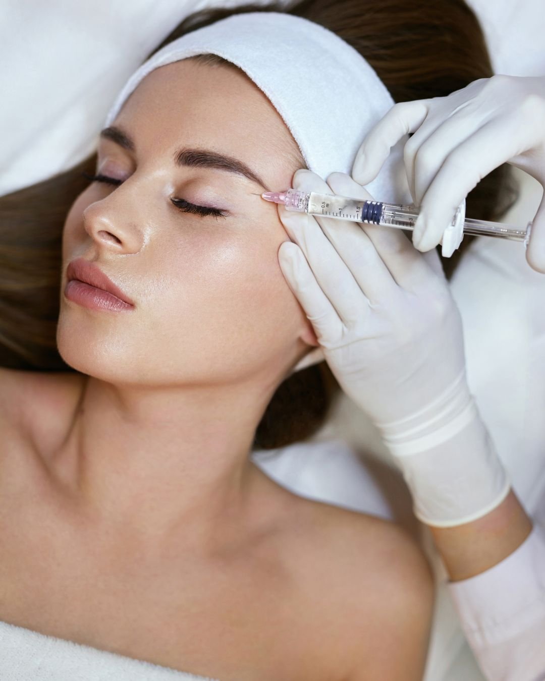 Microneedling treatment