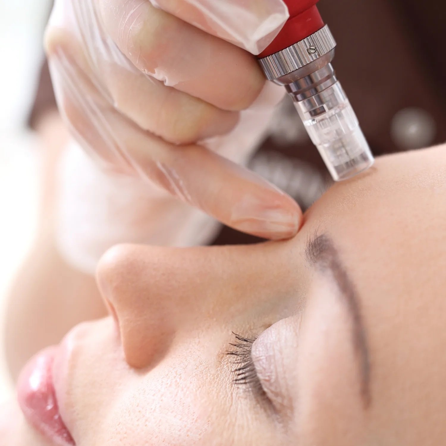 Personalised skin treatment