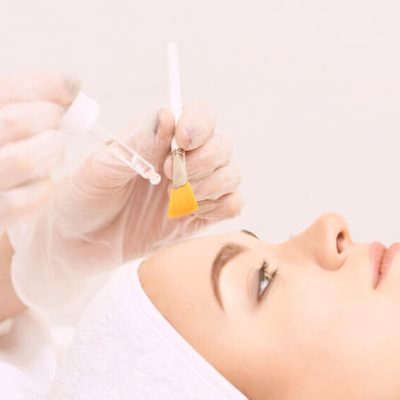 woman getting chemical peel 1 1